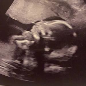 Meet your Posher, Mieesha